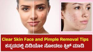 Clear Skin Face and Pimple Removal Tips